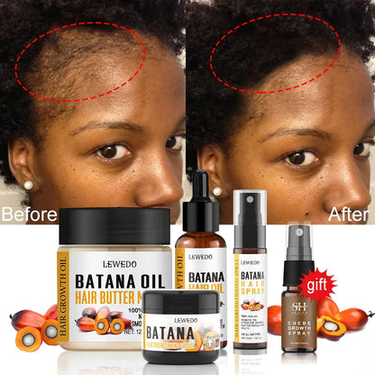 LEWEDO Batana Oil  Natural Hair Care