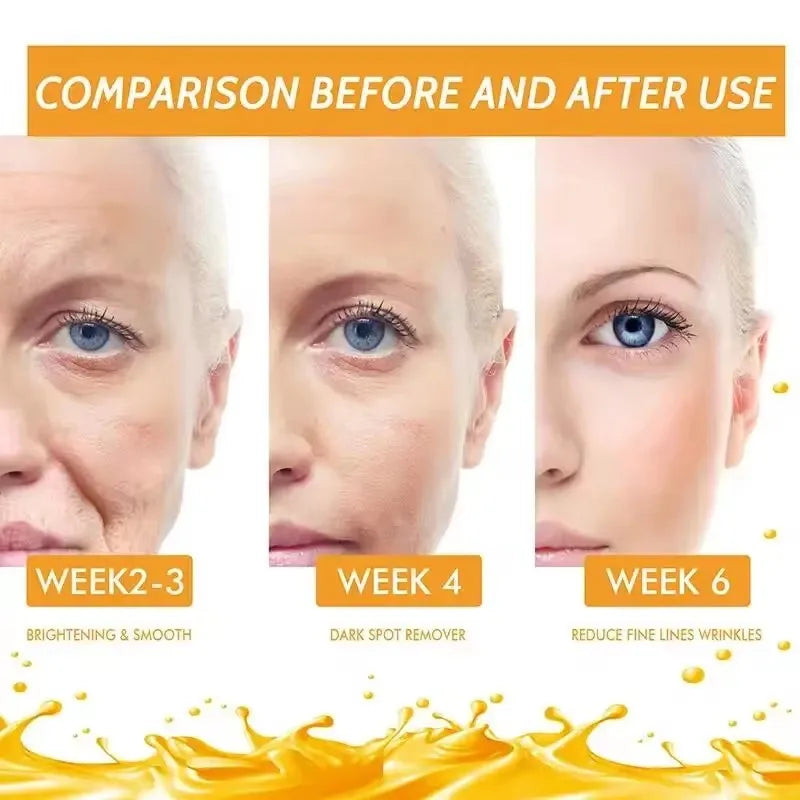 Vitamin C Face Whitening Serum Remove Dark Spots